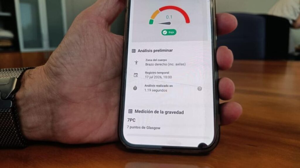 Aragón incorpora inteligencia artificial para detectar más de 300 enfermedades de la piel en Atención Primaria